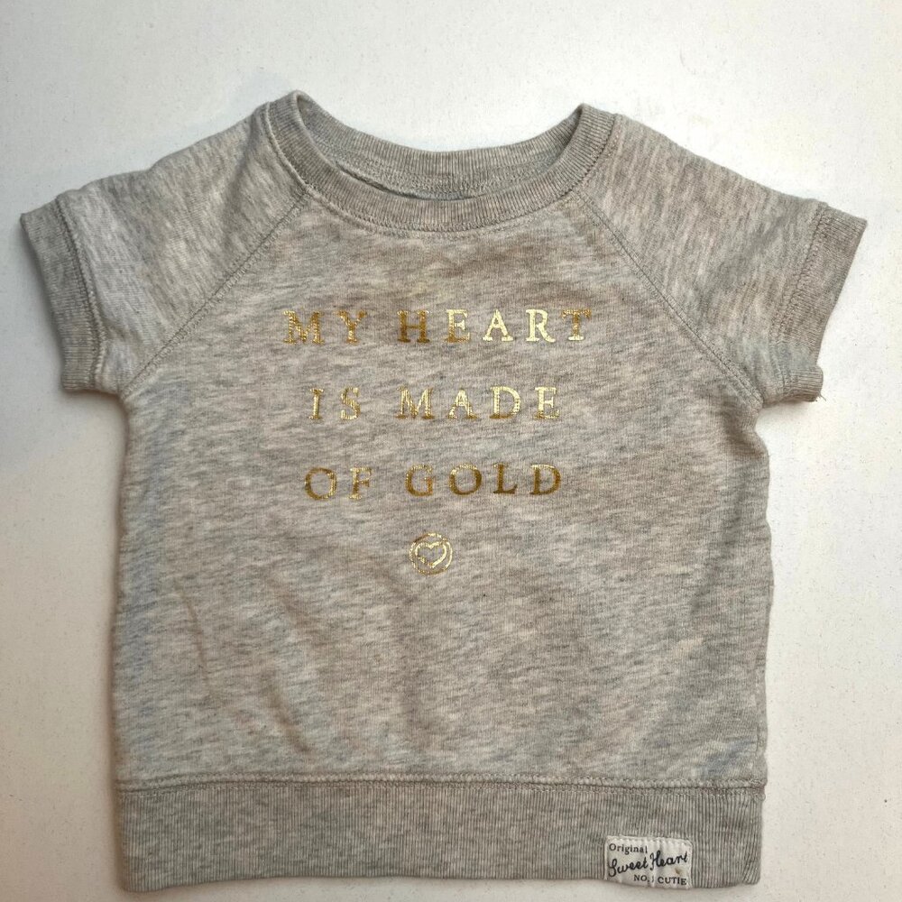 3 Pack | Baby Girl Short Sleeve Tops | 9 Month - Picture 2 of 10